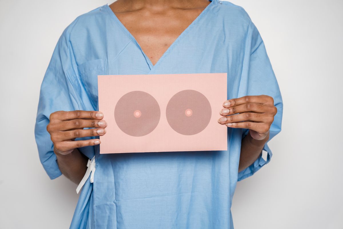 Breast Lift at Qasawa Plastic Surgery in Troy, Michigan