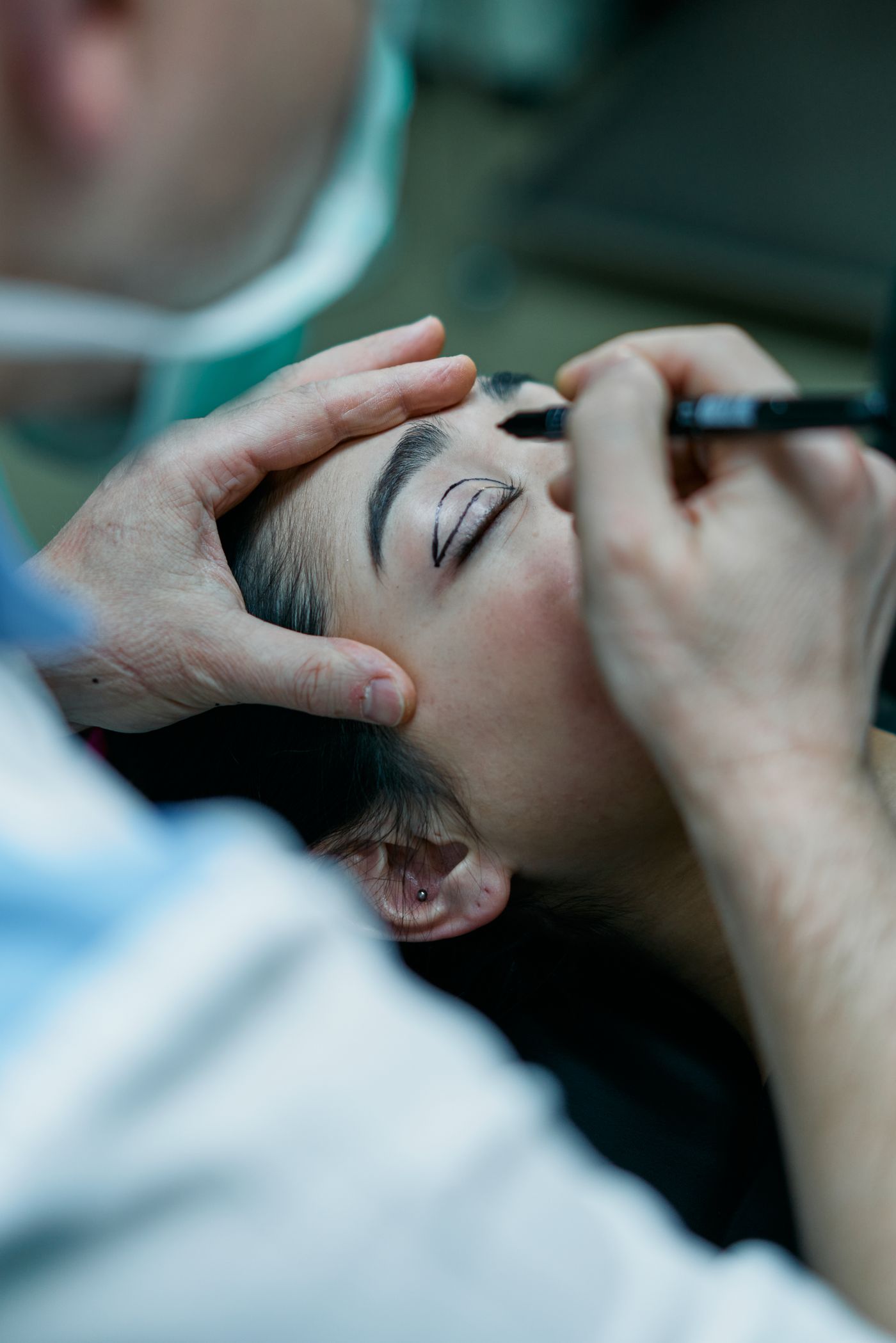 Eyelid Surgery at Qasawa Plastic Surgery in Troy, Michigan